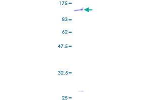 Image no. 1 for Zinc Finger Protein 45 (ZNF45) (AA 1-682) protein (GST tag) (ABIN1326212) (ZNF45 Protein (AA 1-682) (GST tag))