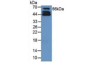 Detection of COL10 in Human Cartilage Tissue using Polyclonal Antibody to Collagen Type X (COL10) (COL10 antibody  (AA 547-680))