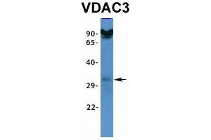 Host:  Rabbit  Target Name:  VDAC3  Sample Type:  HT1080  Antibody Dilution:  1. (VDAC3 antibody  (N-Term))