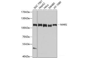 Western blot analysis of extracts of various cell lines using MARS Polyclonal Antibody at dilution of 1:1000. (Mars (MARS) antibody)