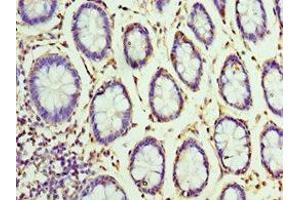 Immunohistochemistry of paraffin-embedded human colon tissue using ABIN7155860 at dilution of 1:100 (VENTX antibody  (AA 1-258))
