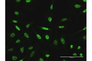 Immunofluorescence of purified MaxPab antibody to GTF3C2 on HeLa cell. (GTF3C2 antibody  (AA 1-911))