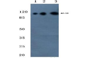 Western blot (WB) analysis of AF-10 antibody at 1/500 dilution. (MLLT10 antibody)