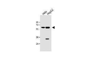 All lanes : Anti-hIL1R-p at 1:1000 dilution Lane 1: Hela whole cell lysate Lane 2: HepG2 whole cell lysate Lysates/proteins at 40 μg per lane. (IL1R1 antibody  (C-Term))