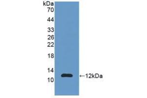 Western blot analysis of recombinant Human S100A11. (S100A11 antibody  (AA 1-105))