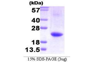 SDS-PAGE (SDS) image for Interleukin 32 (IL32) (AA 1-131) protein (His tag) (ABIN667091)