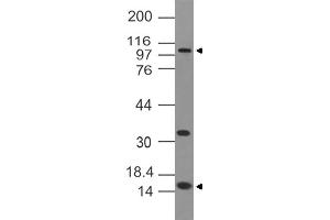 Image no. 1 for anti-DNA (Cytosine-5-)-Methyltransferase 3 alpha (DNMT3A) antibody (ABIN5027477) (DNMT3A antibody)