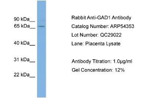 WB Suggested Anti-GAD1  Antibody Titration: 0. (GAD antibody  (N-Term))