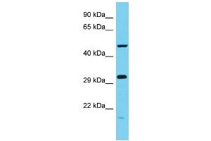 Host: Rabbit Target Name: C6orf211 Sample Type: MCF7 Whole Cell lysates Antibody Dilution: 1. (C6ORF211 antibody  (N-Term))