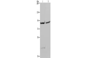 Western Blotting (WB) image for anti-Glycogen Synthase 1 (Muscle) (GYS1) antibody (ABIN2423548) (Glycogen Synthase 1 antibody)