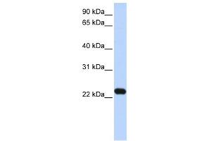 WB Suggested Anti-HBXIP Antibody Titration: 0. (HBXIP antibody  (N-Term))