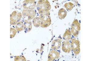 Immunohistochemistry of paraffin-embedded Human stomach using RHOB Polyclonal Antibody at dilution of 1:100 (40x lens). (RHOB antibody)