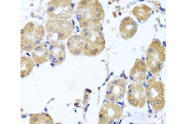 RHOB antibody