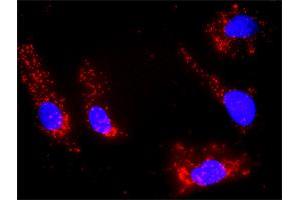 Proximity Ligation Analysis of protein-protein interactions between IL21 and DGKA. (DGKA antibody  (AA 1-735))