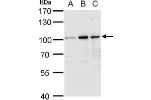 WB Image Aconitase 1 antibody detects Aconitase 1 protein by western blot analysis. (Aconitase 1 antibody)