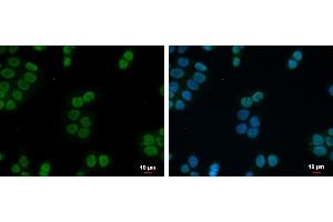 ICC/IF Image ZNF45 antibody [N2C3] detects ZNF45 protein at nucleus by immunofluorescent analysis. (ZNF45 antibody)