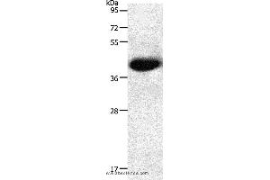 Western blot analysis of Mouse heart tissue, using NGFR Polyclonal Antibody at dilution of 1:950 (NGFR antibody)