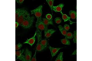 Immunofluorescence (IF) image for anti-S100 Calcium Binding Protein A2 (S100A2) antibody (ABIN6940540)