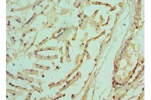 Immunohistochemistry of paraffin-embedded human prostate tissue using ABIN7142216 at dilution of 1:100 (PSMD5 antibody  (Regulatory Subunit 5))