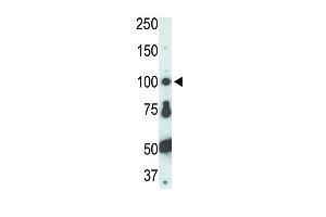 The anti-FER Pab (ABIN392094 and ABIN2841847) is used in Western blot to detect FER in HL-60 cell lysate. (FER antibody  (C-Term))