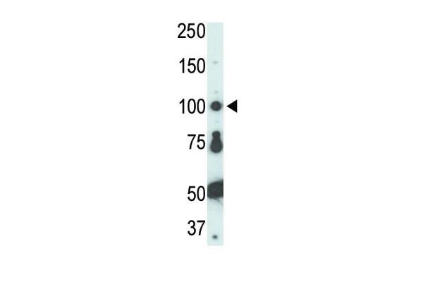 FER antibody  (C-Term)