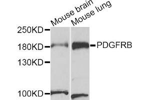 Western blot analysis of extracts of mouse brain and mouse lung cell lines, using PDGFRB antibody. (PDGFRB antibody)