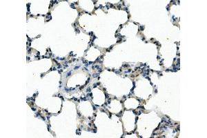 IHC analysis of FOXF1 using anti-FOXF1 antibody (ABIN7601744).