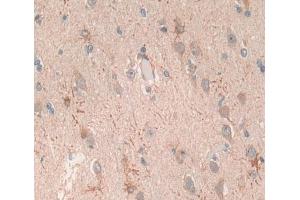 Used in DAB staining on fromalin fixed paraffin- embedded brain tissue (Glutamate Receptor 3 antibody  (AA 649-823))