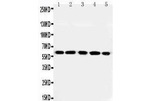 Anti-RGS14 antibody, Western blotting Lane 1: Rat Thymus Tissue Lysate Lane 2: Rat Spleen Tissue Lysate Lane 3: RAJI Cell Lysate Lane 4: CEM Cell Lysate Lane 5: JURKAT Cell Lysate (RGS14 antibody  (C-Term))