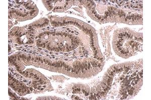 IHC-P Image SNRPD2 antibody detects SNRPD2 protein at nucleus on mouse duodenum by immunohistochemical analysis. (SNRPD2 antibody)