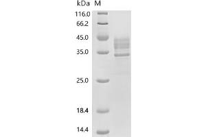 (Tris-Glycine gel) Discontinuous SDS-PAGE (reduced) with 5 % enrichment gel and 15 % separation gel.