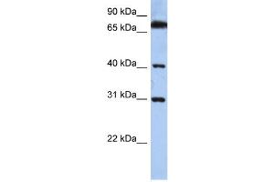 WB Suggested Anti-DHRSX Antibody Titration: 0. (DHRSX antibody  (C-Term))