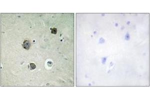 Immunohistochemistry analysis of paraffin-embedded human brain tissue, using CDK5 (Ab-15) Antibody. (CDK5 antibody  (AA 1-50))