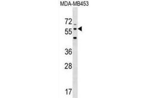 Western Blotting (WB) image for anti-Leucine Rich Repeat Transmembrane Neuronal 2 (LRRTM2) antibody (ABIN3000490)