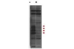 Western blot using  affinity purified anti-MLF1IP / PBIP1 antibody shows detection of endogenous MLF1IP protein (a tier of four modified protein bands indicated by the arrowheads) in lysates of Hela cells (- lane). (MLF1 antibody  (N-Term))