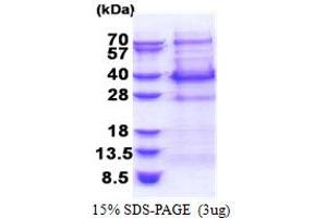 SDS-PAGE (SDS) image for B-Cell CLL/lymphoma 7C (BCL7C) (AA 1-217) protein (His tag) (ABIN5853394) (BCL7C Protein (AA 1-217) (His tag))