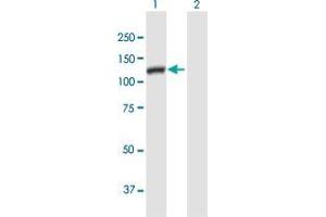 Western Blot analysis of DSE expression in transfected 293T cell line by DSE MaxPab polyclonal antibody. (DSE antibody  (AA 1-958))