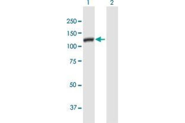 DSE antibody  (AA 1-958)