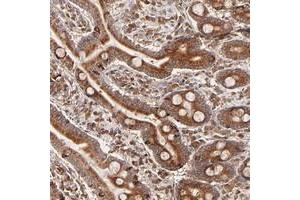 Immunohistochemical staining of human duodenum with C14orf45 polyclonal antibody  shows strong cytoplasmic positivity in glandular cells. (C14orf45 antibody)