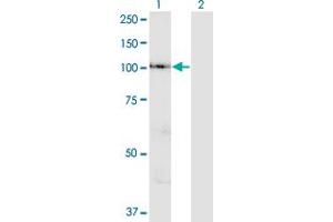 Western Blot analysis of VPS41 expression in transfected 293T cell line by VPS41 polyclonal antibody (A01).