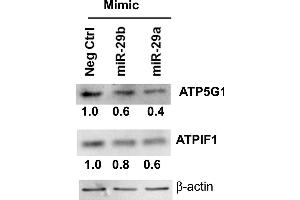 miR-29-b-1/a downregulate ATP5G1 and ATPIF1 protein expression in LCC9 breast cancer cells. (ATP5G1 antibody  (Center))