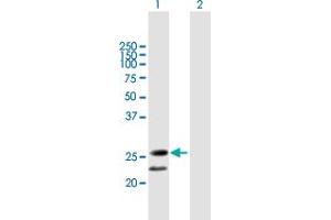Western Blot analysis of C20orf71 expression in transfected 293T cell line by C20orf71 MaxPab polyclonal antibody. (BPIFA3 antibody  (AA 1-218))