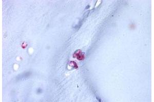 Immunohistochemistry (Formalin/PFA-fixed paraffin-embedded sections) of human cartilage tissue with ACAN polyclonal antibody . (Aggrecan antibody  (C-Term))