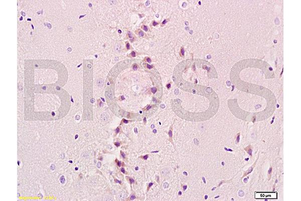 SLC5A5 antibody  (AA 525-618)