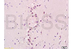 Formalin-fixed and paraffin embedded rat brain tissue labeled with Anti-NIS Polyclonal Antibody, Unconjugated (ABIN668751) at 1:200, followed by conjugation to the secondary antibody and DAB staining