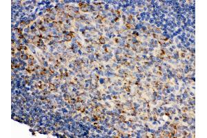 Immunohistochemistry (Paraffin-embedded Sections) (IHC (p)) image for anti-CD19 Molecule (CD19) (AA 307-337), (Middle Region) antibody (ABIN3043389) (CD19 antibody  (Middle Region))