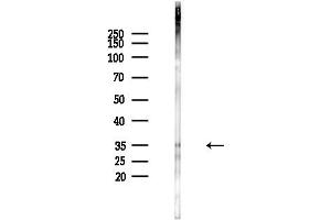 anti-Mitochondrially Encoded NADH Dehydrogenase 1 (MT-ND1) (Internal Region) antibody