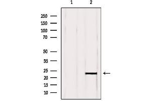 Western blot analysis of extracts from Mouse brain, using RBBP9 Antibody. (RBBP9 antibody  (Internal Region))