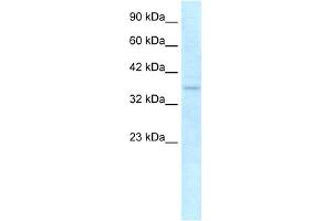 WB Suggested Anti-NLRC4 Antibody Titration: 0.