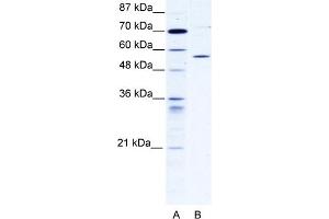 CCT4 antibody - C-terminal region  validated by WB using 293T cells lysate CCT4 is supported by BioGPS gene expression data to be expressed in HEK293T (CCT4 antibody  (C-Term))